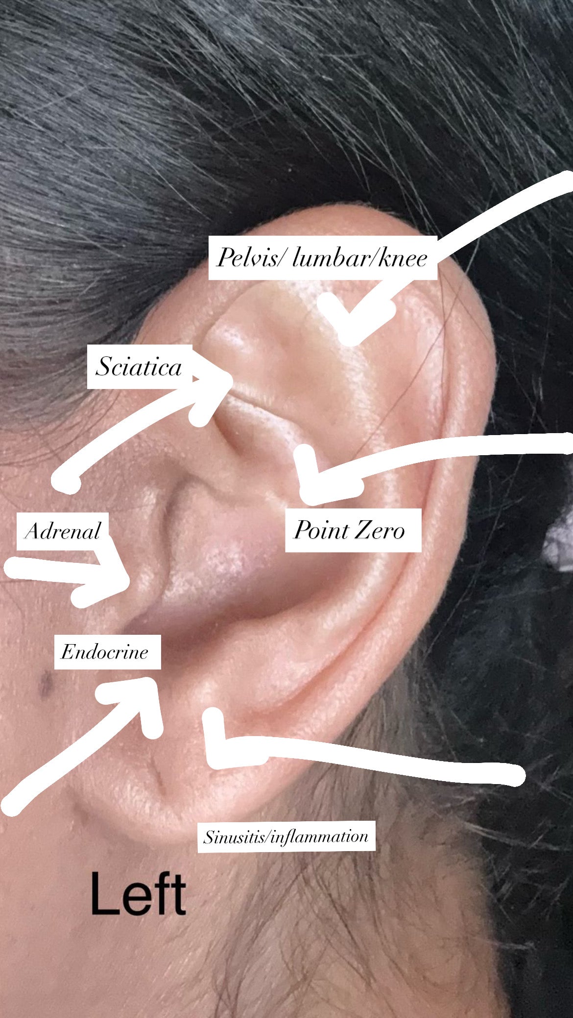 Auricular Diagnosis