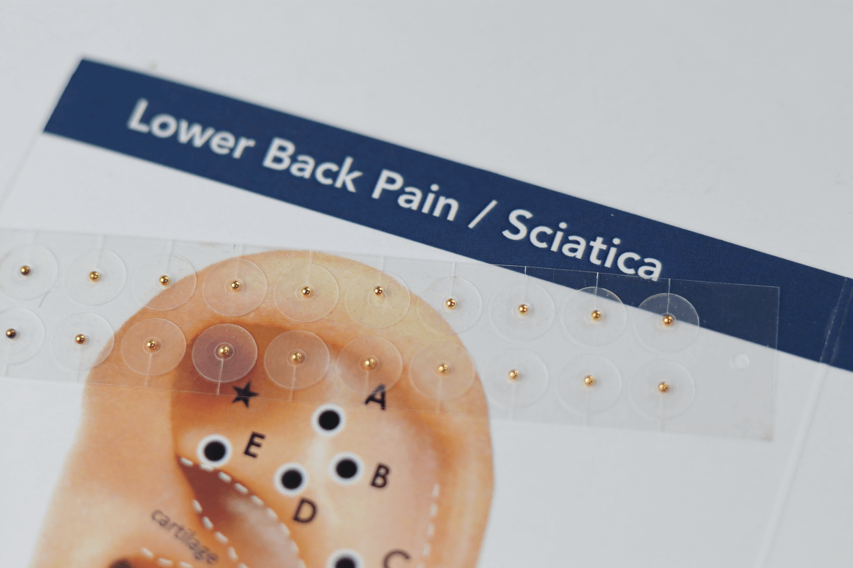 Back Pain and Sciatica Relief Acupressure Ear Seeds Kit