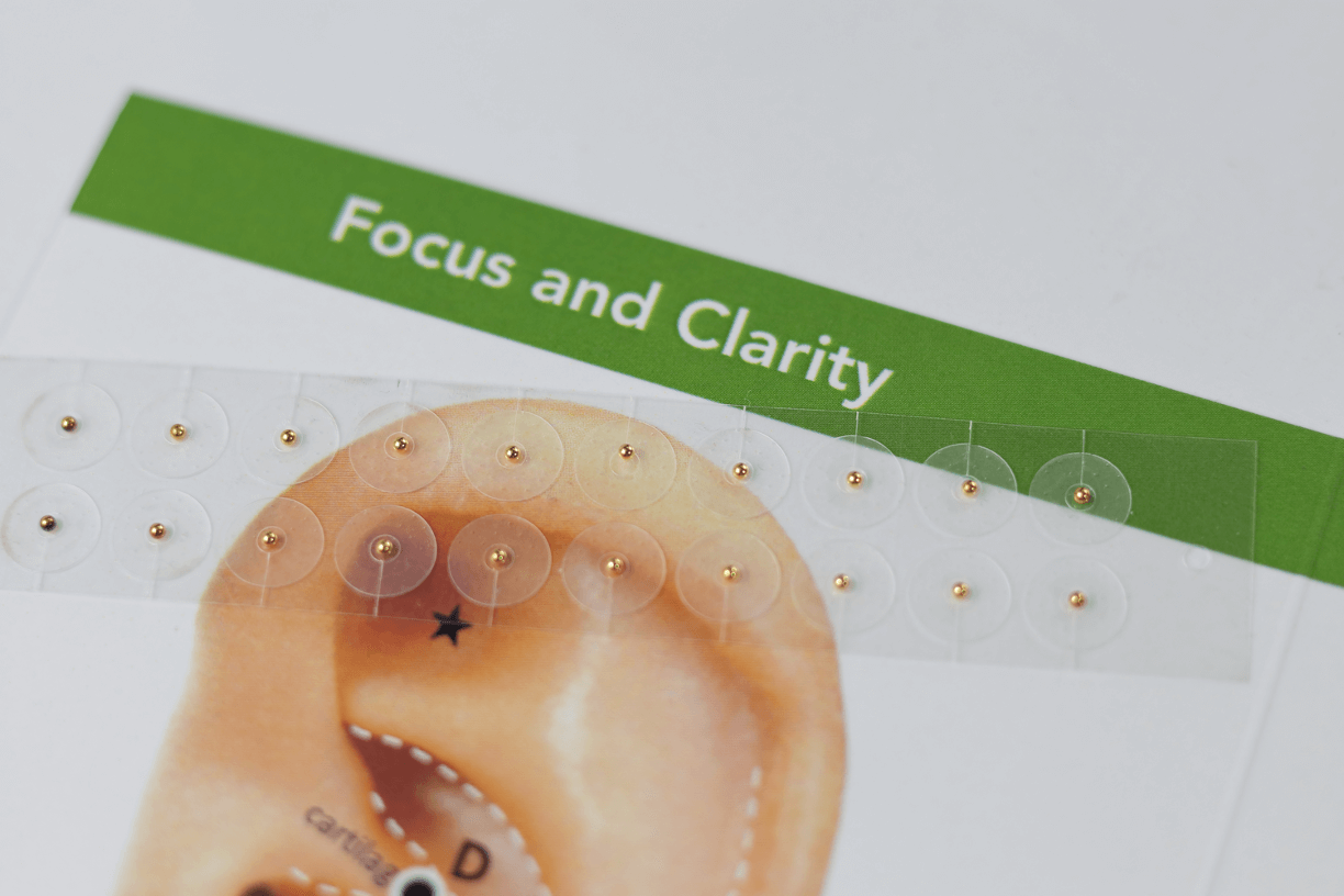 Focus and Clarity Support Acupressure Ear Seeds Kit~Suitable For Kids