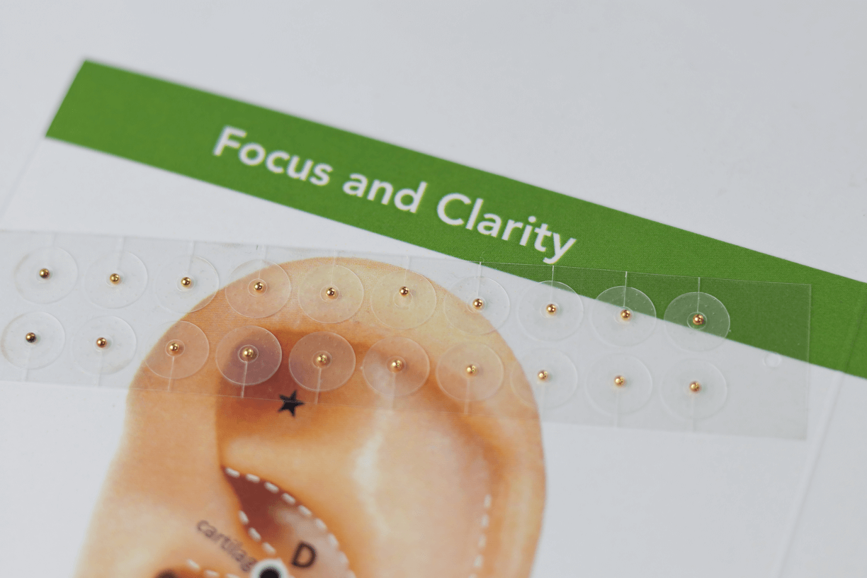 Focus and Clarity Support Acupressure Ear Seeds Kit